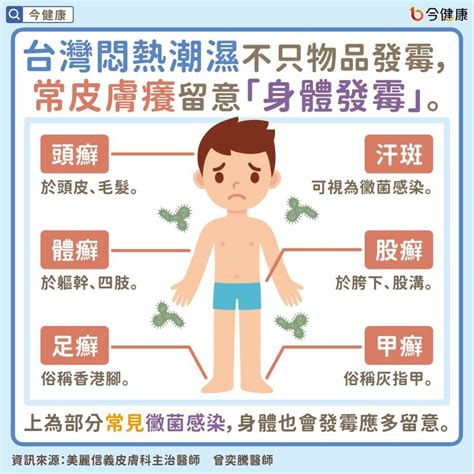 皮膚無故痕癢|常常皮膚癢怎麼辦：原因、處理重點指南大全